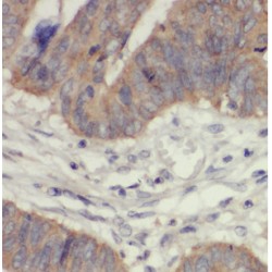 Ankyrin Repeat And SOCS Box Protein 8 (ASB8) Antibody