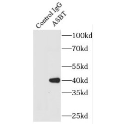 Ileal Sodium/Bile Acid Cotransporter (SLC10A2) Antibody