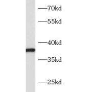 WB analysis of mouse small intestine tissue, using ASBT antibody (1/300 dilution).