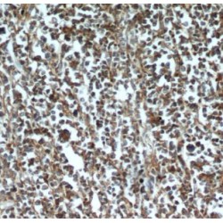 Histone Chaperone ASF1A (ASF1A) Antibody