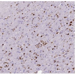 Set1/Ash2 Histone Methyltransferase Complex Subunit ASH2 (ASH2L) Antibody