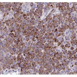 Argininosuccinate Lyase (ASL) Antibody