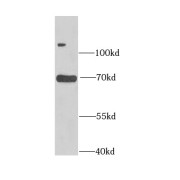 WB analysis of human testis tissue, using ASMTL antibody (1/1500 dilution).