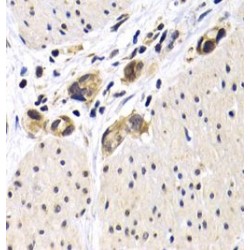 Cyclic AMP-Dependent Transcription Factor ATF-2 (ATF2) Antibody