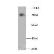 WB analysis of K-562 cells, using ATF2 antibody (1/1000 dilution).