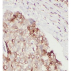 ATF2-Specific Antibody