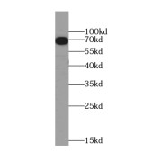 WB analysis of HeLa cells, using ATF2-Specific antibody (1/600 dilution).