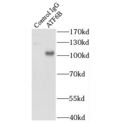 Activating Transcription Factor 6 Beta (ATF6B) Antibody