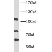 WB analysis of Jurkat cells, using ATF6B antibody (1/1000 dilution).
