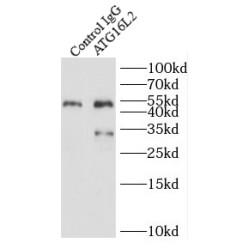 Autophagy Related 16 Like 2 (ATG16L2) Antibody