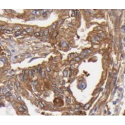 Autophagy-Related Protein 2 Homolog B (ATG2B) Antibody