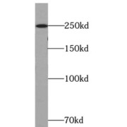 WB analysis of HeLa cells, using ATG2B antibody (1/600 dilution).