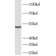 WB analysis of mouse testis tissue, using ATG4C antibody (1/500 dilution).