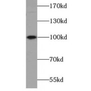 WB analysis of mouse brain tissue, using ATP1A2-Specific antibody (1/800 dilution).