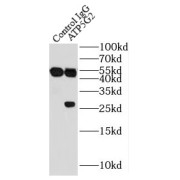 IP analysis of HEK-293 cell lysate (3200 µg), using ATP5G2-Specific antibody (3 µg, detection: 1/300 dilution).
