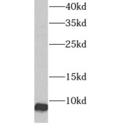 WB analysis of human liver tissue, using ATP5I antibody (1/300 dilution).