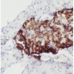 V-Type Proton ATPase Catalytic Subunit A (ATP6V1A) Antibody