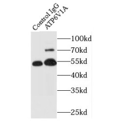 V-Type Proton ATPase Catalytic Subunit A (ATP6V1A) Antibody