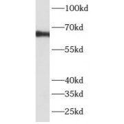 WB analysis of mouse kidney tissue, using ATP6V1A antibody (1/500 dilution).