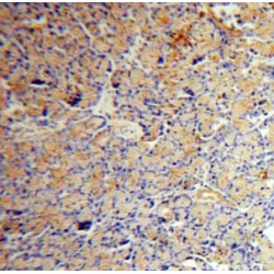 V-Type Proton ATPase Catalytic Subunit A (ATP6V1A) Antibody