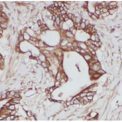V-Type Proton ATPase Subunit B, Brain Isoform (ATP6V1B2) Antibody