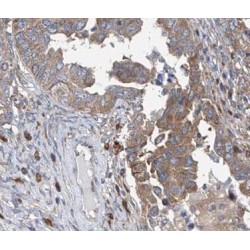 V-Type Proton ATPase Subunit C 1 (ATP6V1C1) Antibody