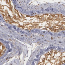 V-Type Proton ATPase Subunit F (ATP6V1F) Antibody