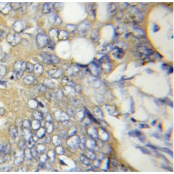 ATP Synthase Mitochondrial F1 Complex Assembly Factor 2 (ATPAF2) Antibody