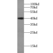 WB analysis of HeLa cells, using AURKB antibody (1/500 dilution).