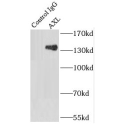 Tyrosine-Protein Kinase Receptor UFO (AXL) Antibody