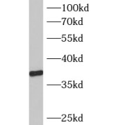WB analysis of mouse brain tissue, using B3GALT6 antibody (1/500 dilution).