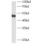WB analysis of Jurkat cells, using B3GNT7 antibody (1/1000 dilution).
