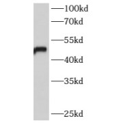 WB analysis of mouse heart tissue, using B4GALT6 antibody (1/600 dilution).