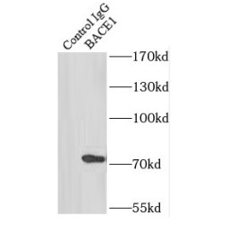 Beta-Secretase 1 (BACE1) Antibody