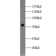 WB analysis of mouse brain tissue, using BACE1 antibody (1/500 dilution).