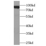 WB analysis of HEK-293 cells, using BACH1 antibody (1/1000 dilution).