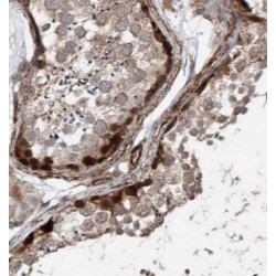 BAG1S-specific Antibody