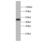 WB analysis of mouse brain tissue, using BAG1S/1M/1L antibody (1/800 dilution).