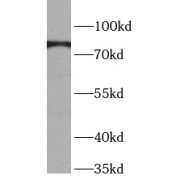 WB analysis of HeLa cells, using BAG3 antibody (1/1000 dilution).