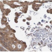 WB analysis of HeLa cells, using BAIAP2L1 antibody (1/600 dilution).