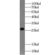 WB analysis of A431 cells, using BAK antibody (1/1000 dilution).