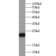 WB analysis of MCF-7 cells, using BAX antibody (1/4000 dilution).