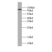 WB analysis of K-562 cells, using BBS2 antibody (1/1000 dilution).