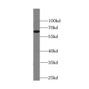 WB analysis of mouse testis tissue, using BBS6 antibody (1/600 dilution).
