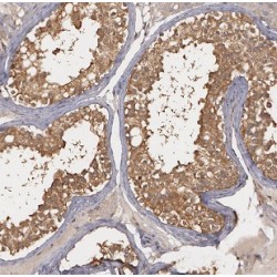 Bardet-Biedl Syndrome 7 Protein (BBS7) Antibody