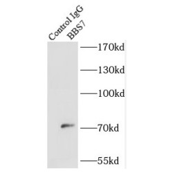 Bardet-Biedl Syndrome 7 Protein (BBS7) Antibody