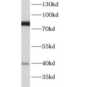 WB analysis of human brain tissue, using BBS7 antibody (1/1500 dilution).