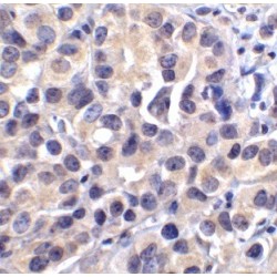 Branched-Chain-Amino-Acid Aminotransferase, Cytosolic (BCAT1) Antibody