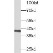 WB analysis of mouse kidney tissue, using BCAT2 antibody (1/800 dilution).