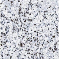 2-Oxoisovalerate Dehydrogenase Subunit Beta, Mitochondrial (BCKDHB) Antibody